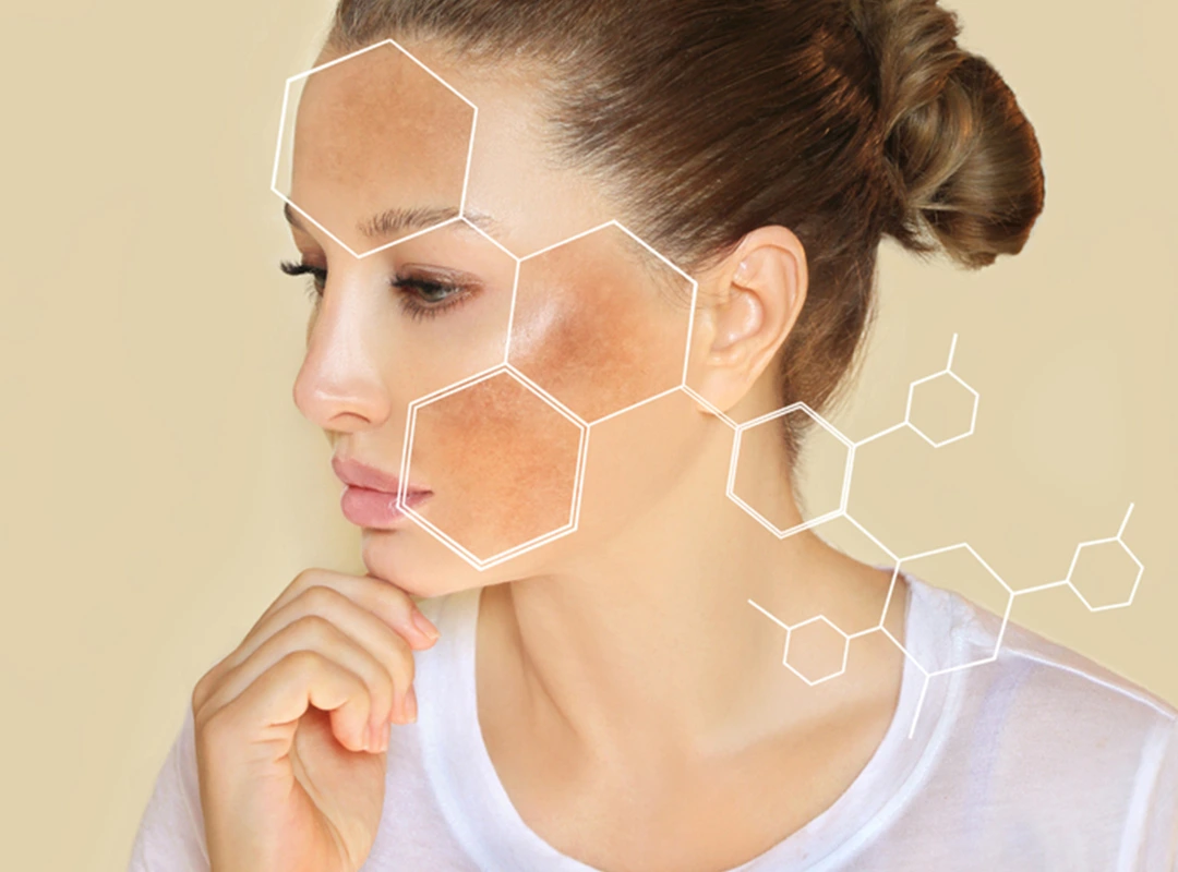 skin-clinic-near-okhla-delhi